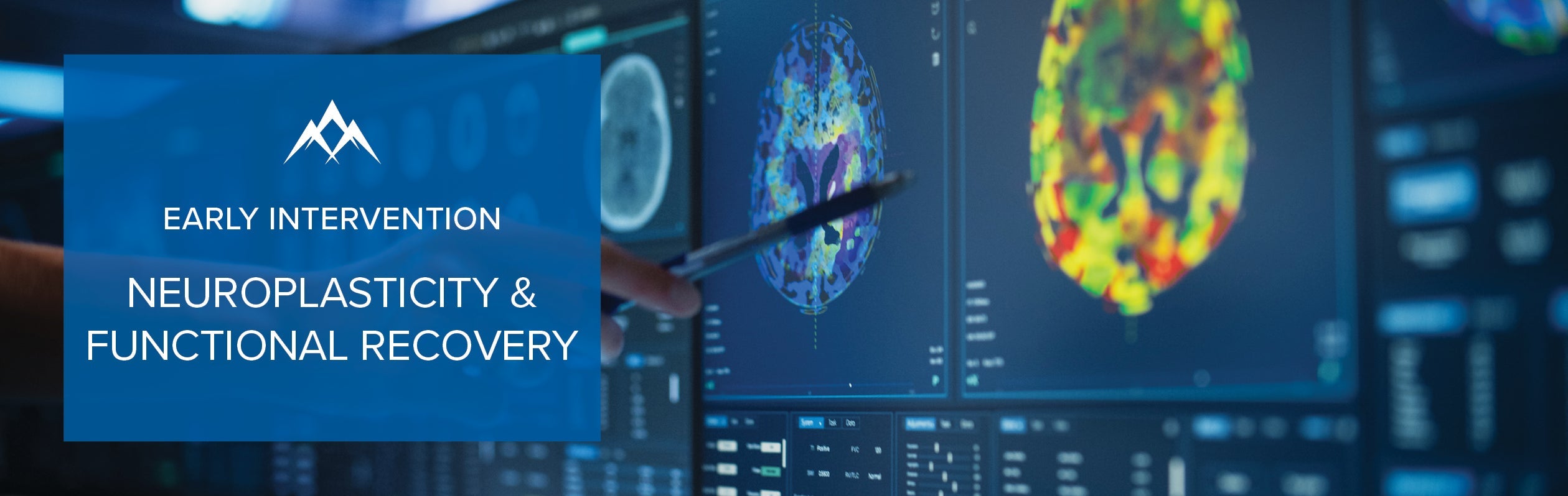 Early Intervention in Stroke Recovery: Maximizing Neuroplasticity in the Acute and Subacute Phases