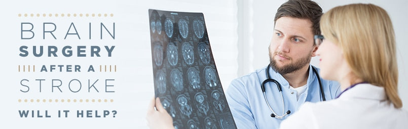 Brain Surgery After a Stroke, Brain Surgery After Stroke