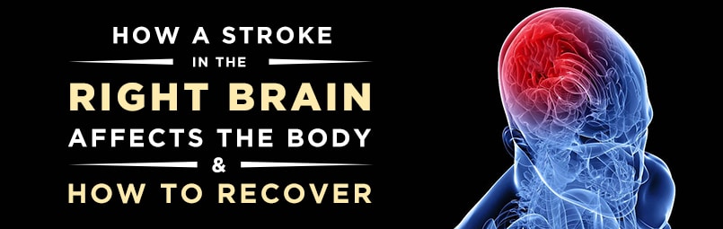Guide to Recovering From a Right Brain Stroke