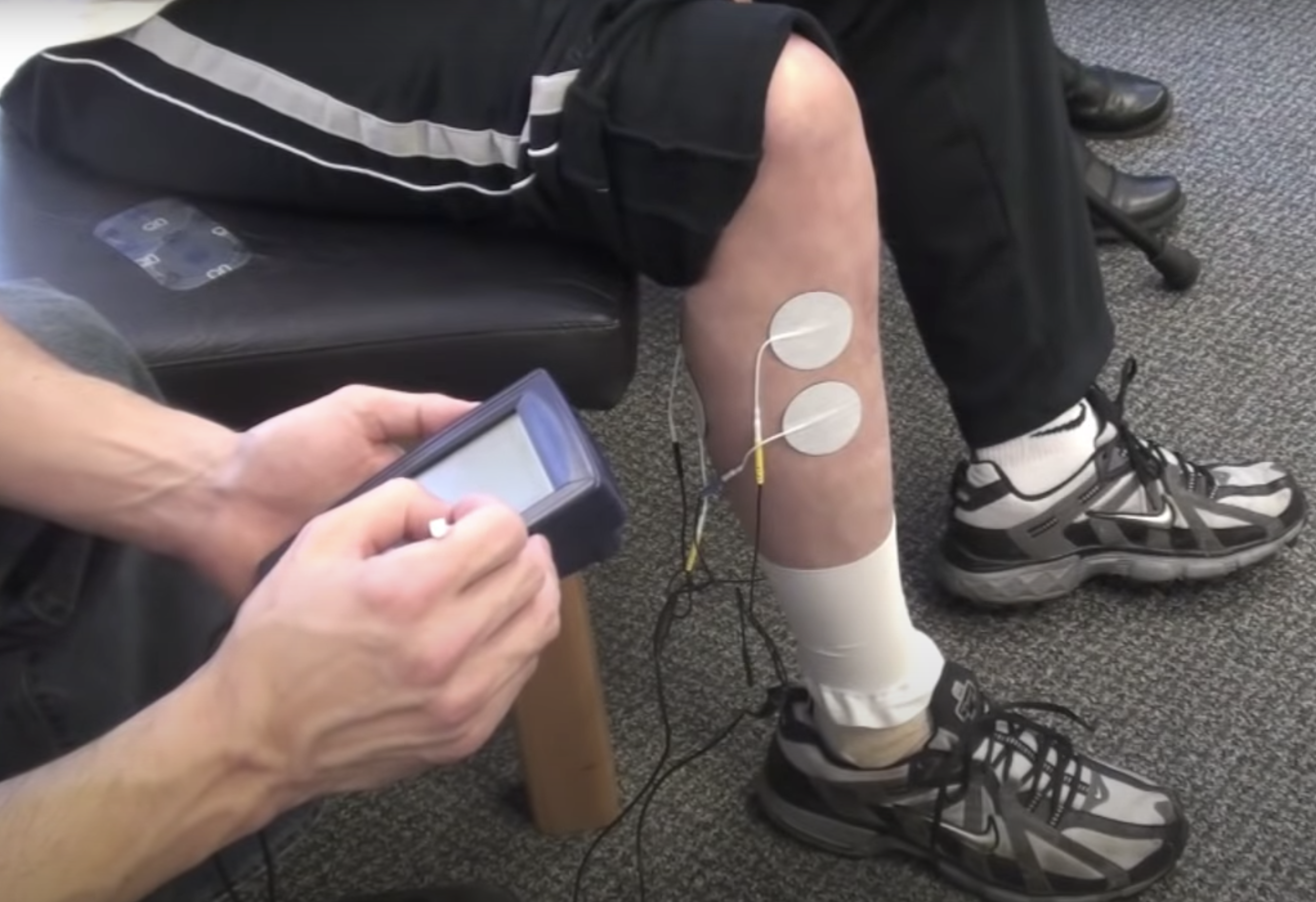 SMTI foot drop treatment