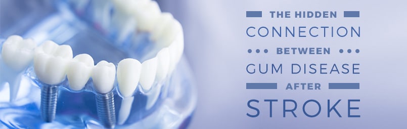 The Hidden Connection Between Gum Disease and Stroke – Saebo