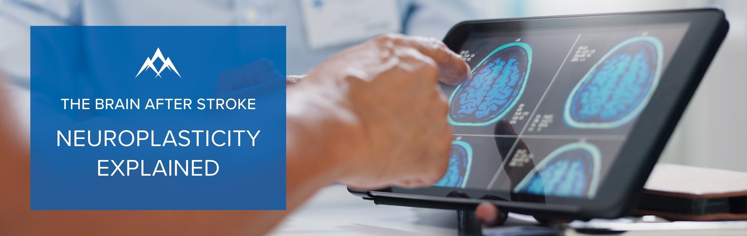 Neuroplasticity Explained: The Science of Brain Recovery After Stroke