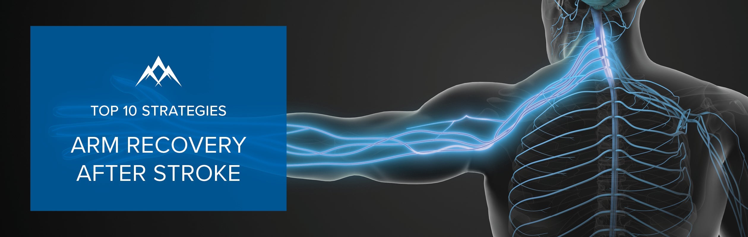 Top 10 Evidence Based Arm Recovery Strategies After Stroke With Saebo