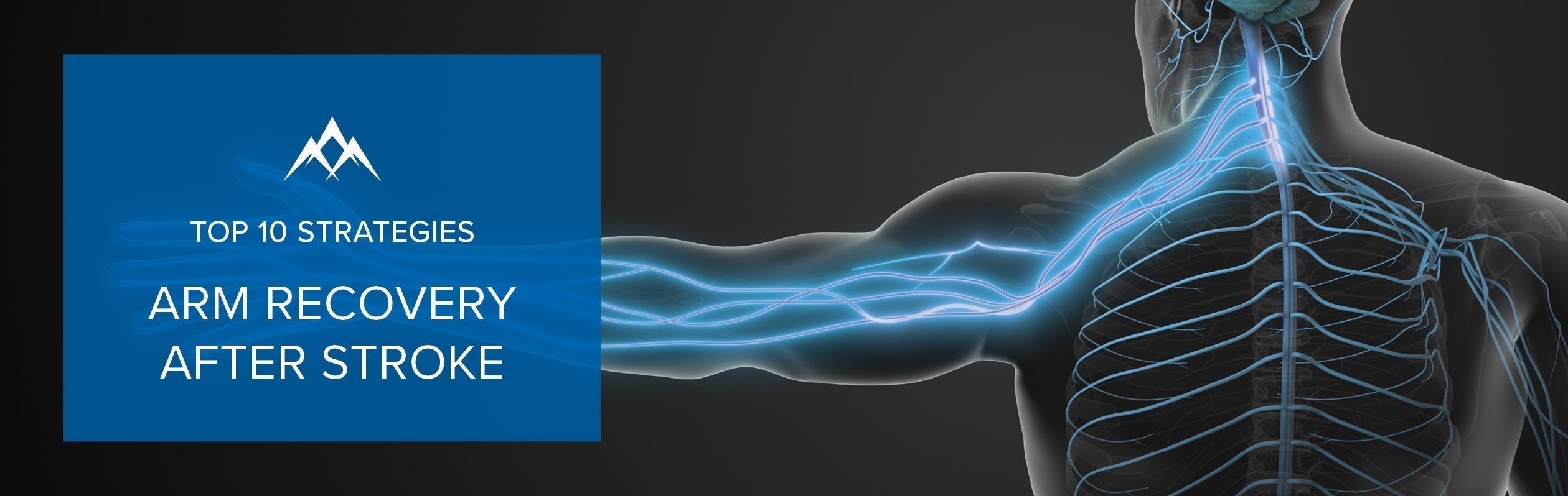 Top 10 Evidence Based Arm Recovery Strategies After Stroke With Saebo