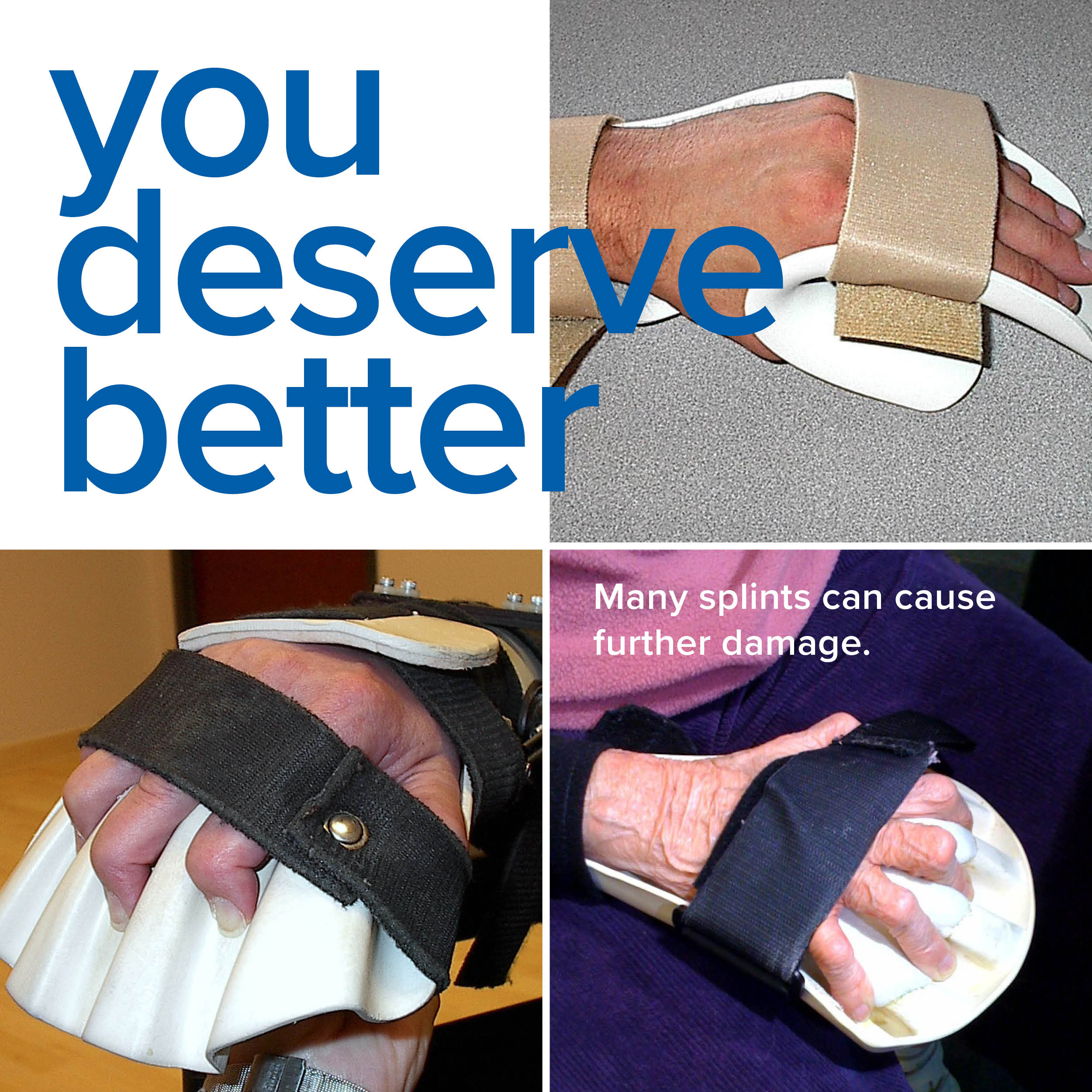 SaeboStretch | Dynamic Resting Hand Splint for Stroke Recovery